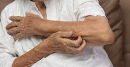 The reasons why elderly people experience itchy skin