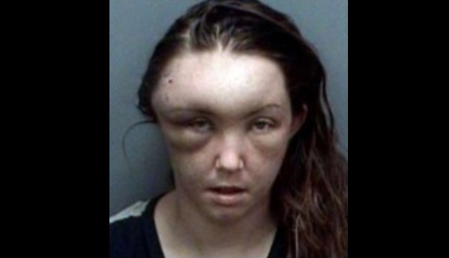 Woman Arrested For Beating Herself Up