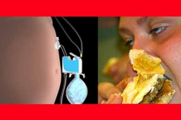 Device sucks food from stomach so people can keep eating